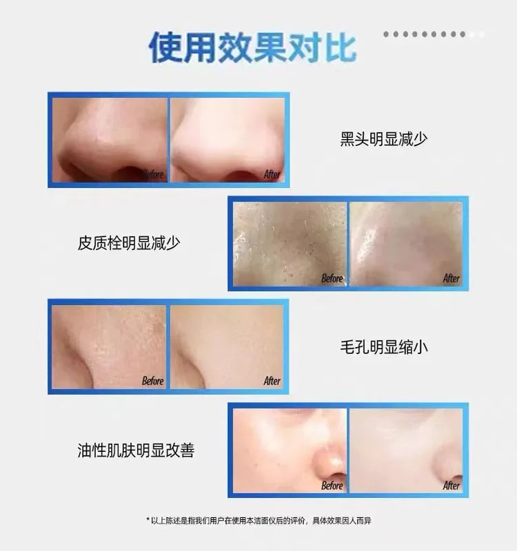 Cleansing Soft Hair Electric Face Brush Facial Men's and Women's Face Washing Beauty Household Pore Cleaning