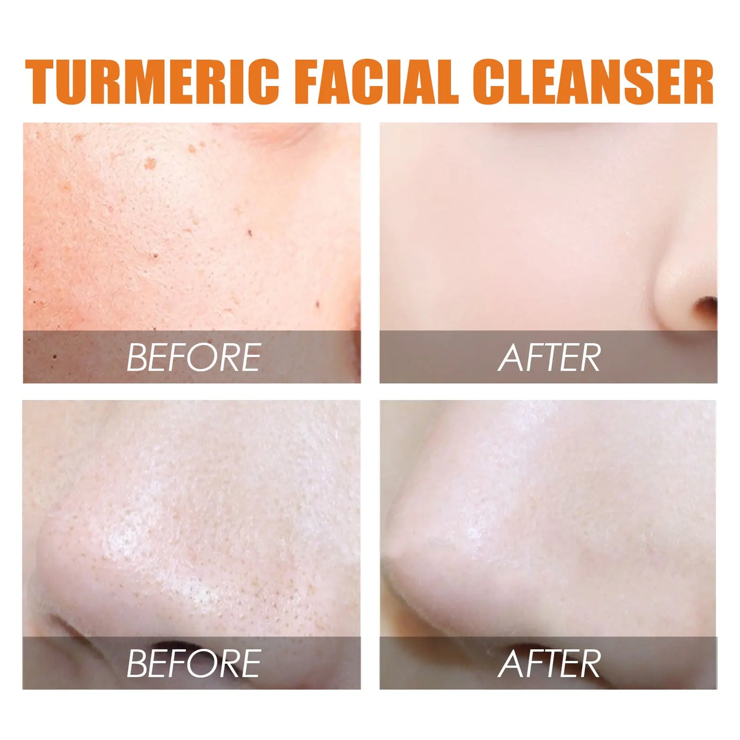 Turmeric Facial Cleanser Deeply Cleanses and Repairs The Skin Barrier Moisturizes Shrinks Pores Oil Control Blackheads Face