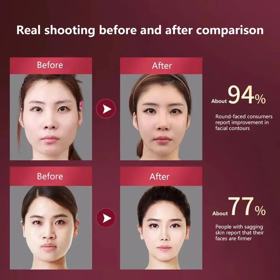 LED Photon Therapy Facial Lifting & Slimming Massager My Store 2