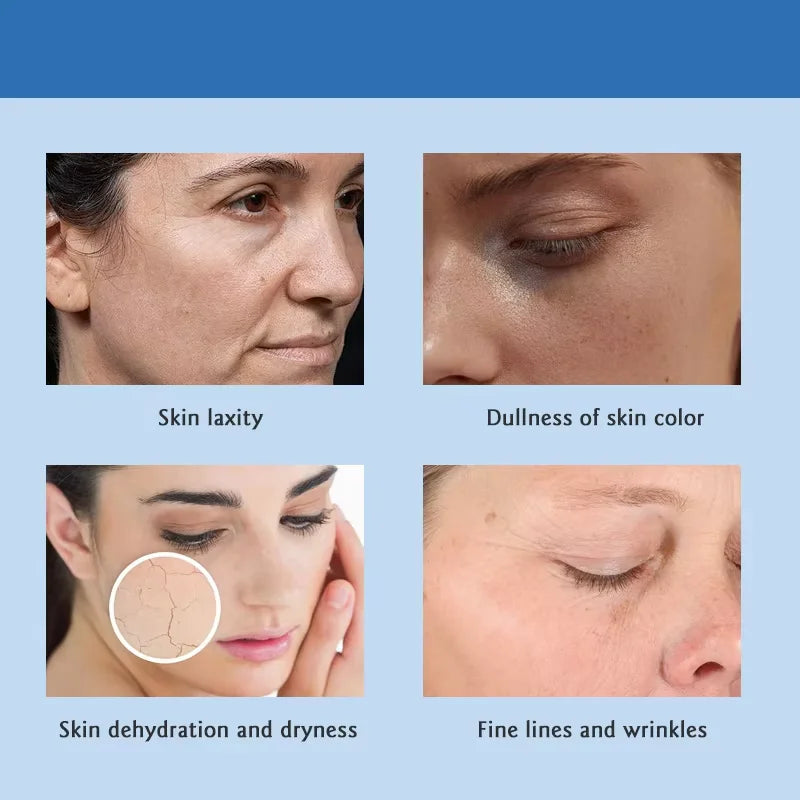 Hyaluronic Acid Anti-Aging Serum MicroInfusion Stamp for Face - Firming Moisturize Essence Texture, All Skin Home Care Kit