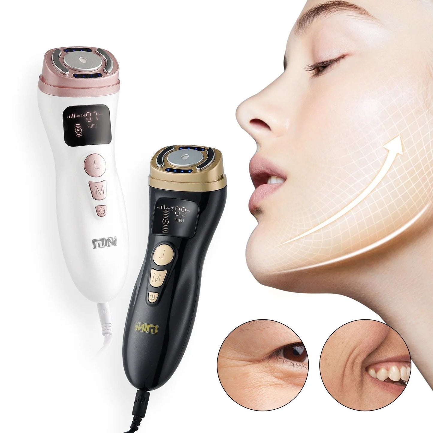 Mini HIFU RF EMS Facial Lifting & Skin Tightening Device My Store 2