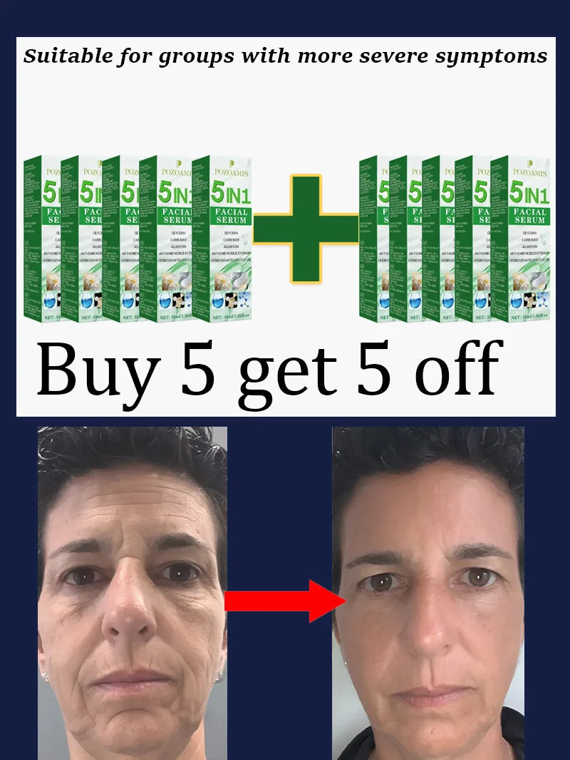 Daily Facial Skincare Quͧiͥcͨᴋⷦly Reͤdͩuͧcͨeͤ Wrͬiͥnᴋⷦleͤs͛