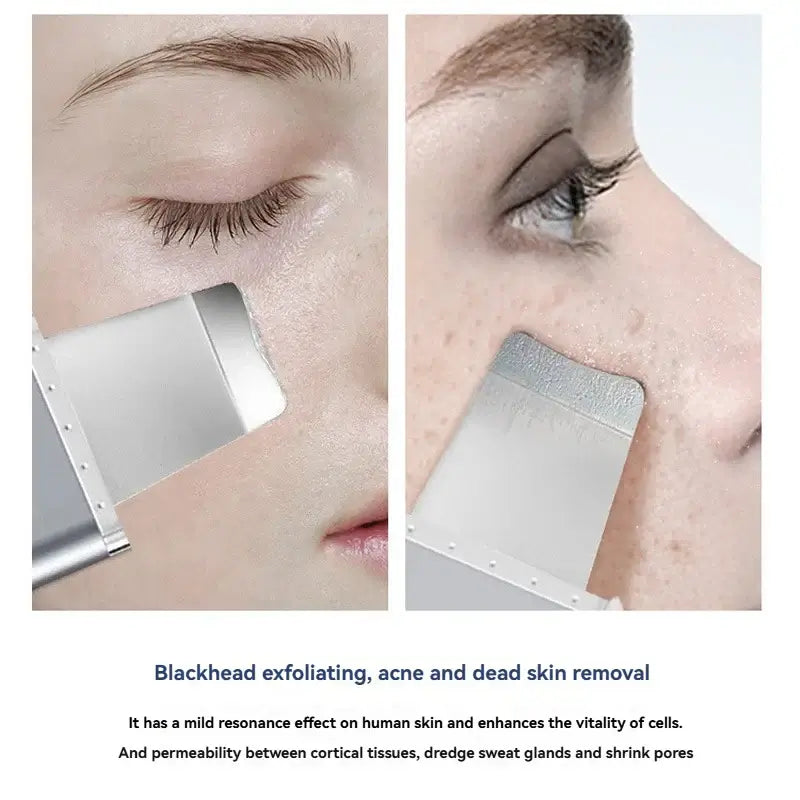 Pore Cleaning Device Facial Care Introduction Device Skin Scraper Blackhead Keratin Remover Blackhead Scraper Vibration Massage