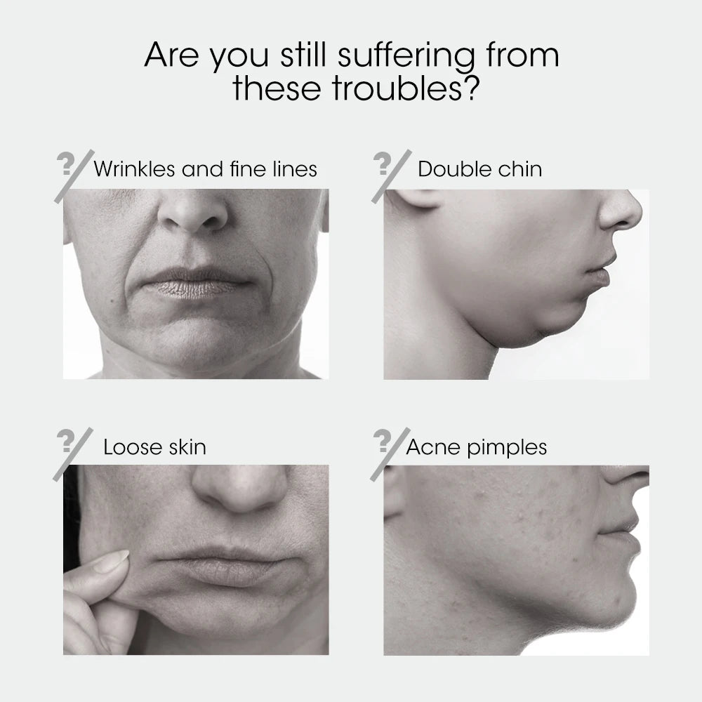 V Face Facial Machine Electric V-Line Up Lift Belt Face Massage LED Face Skin Lifting Firming Beauty Device Double Chin Reducer