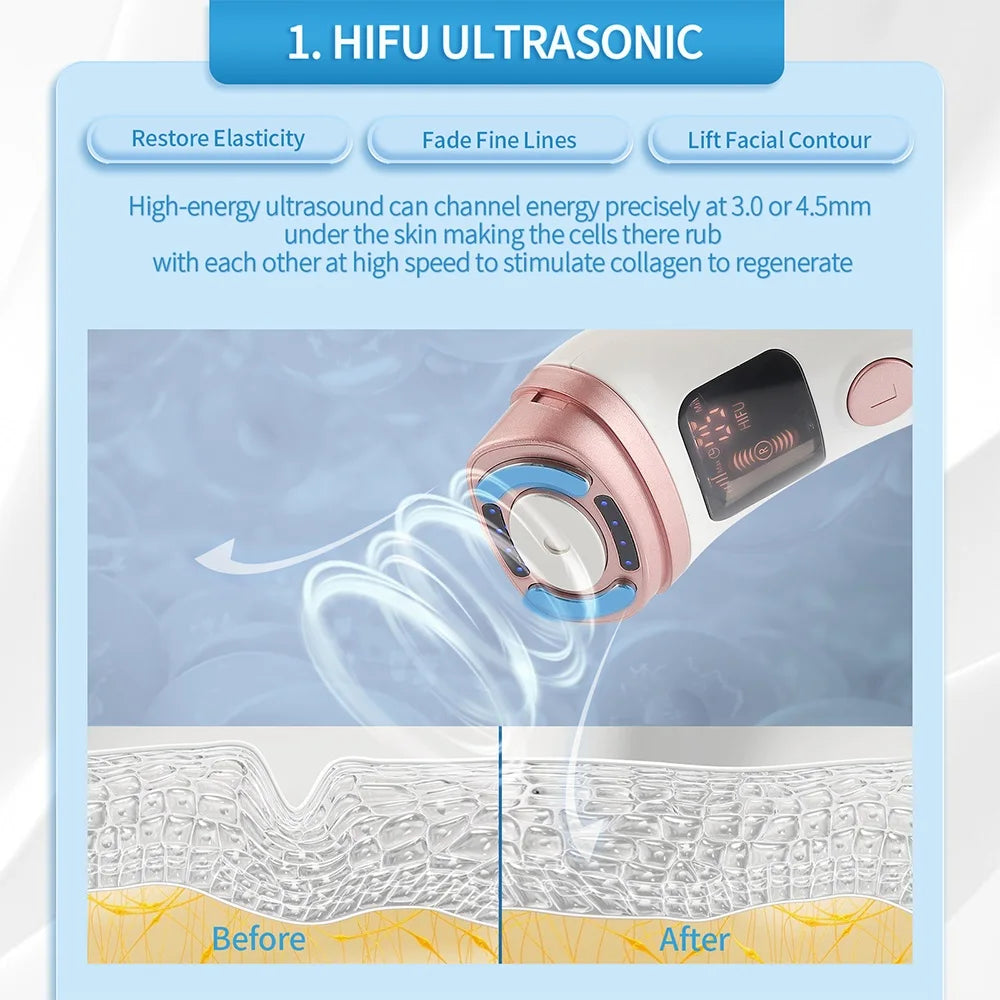Mini HIFU RF EMS Facial Lifting & Skin Tightening Device My Store 2